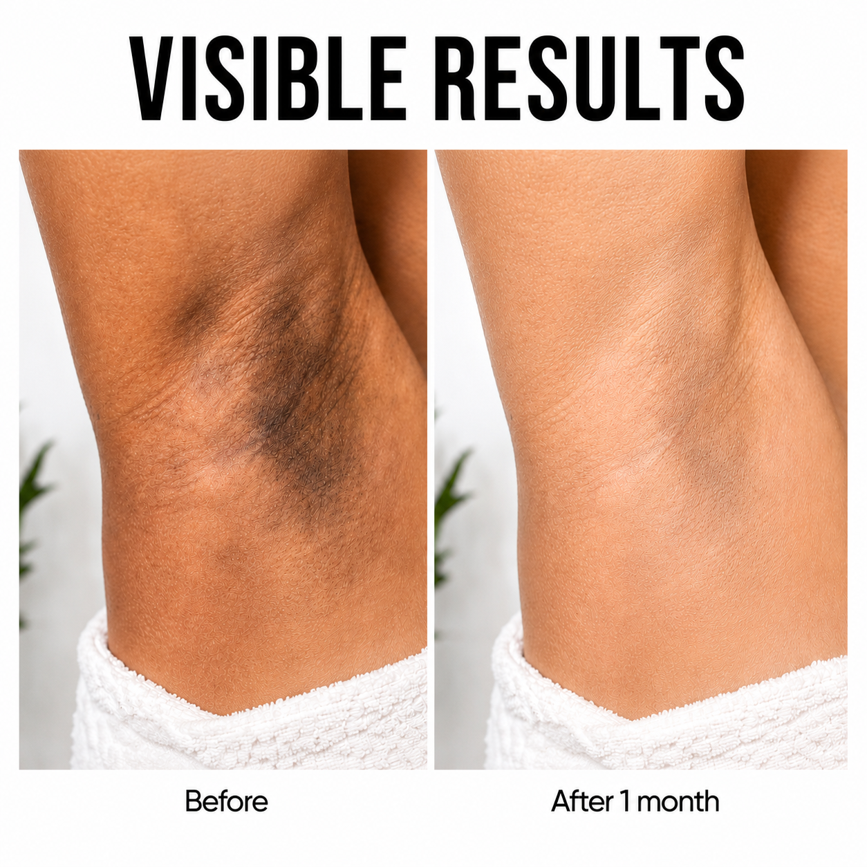 TurmaGlow™ 2.0 - Dark Spot & Acne Clearing Bar